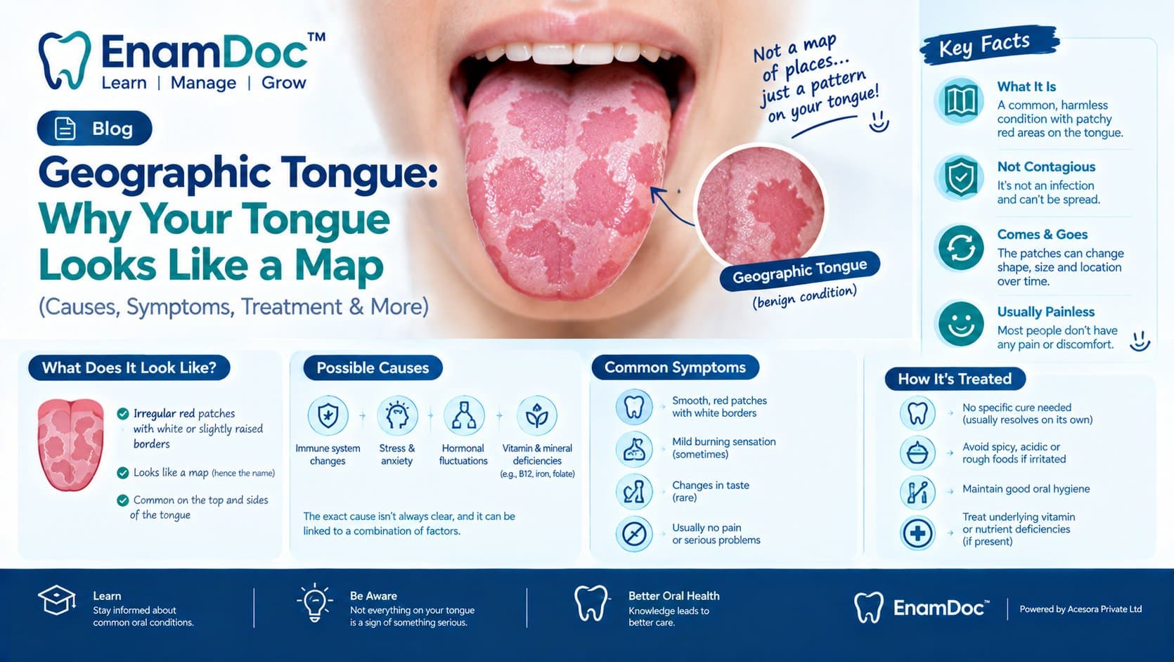 EnamDoc blog cover showing a close-up of a tongue with map-like red patches characteristic of geographic tongue, with educational sections explaining its appearance, possible causes, symptoms, treatment, and key facts for patients and dental students.