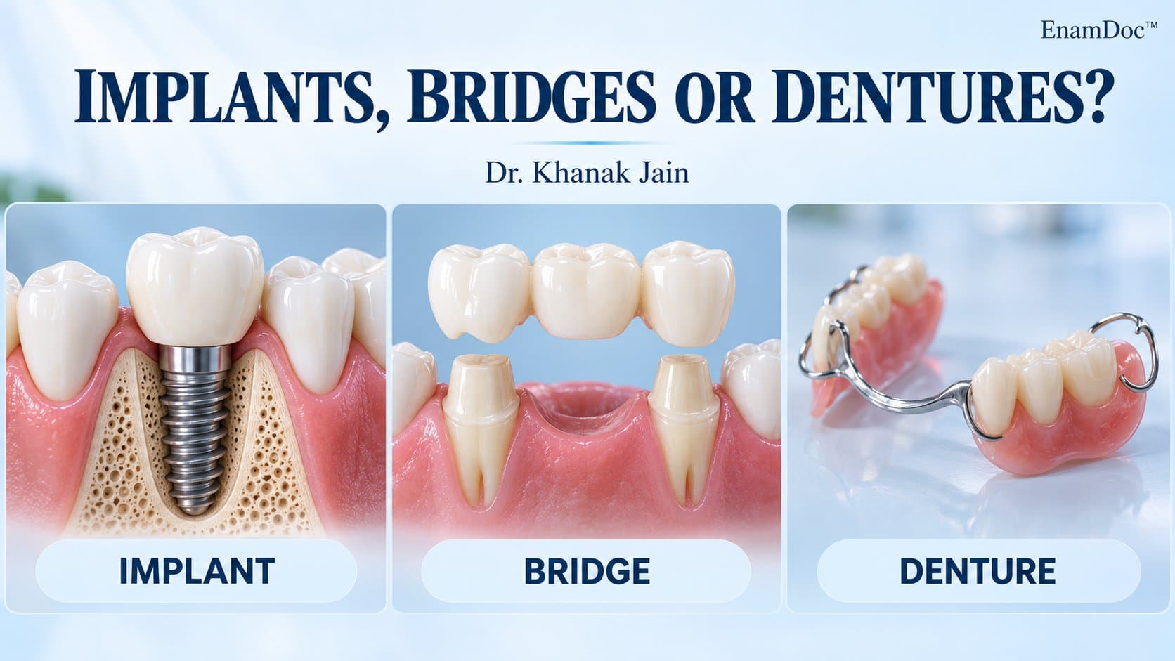 Side-by-side dental illustrations comparing a single implant, tooth-supported bridge and removable partial denture.