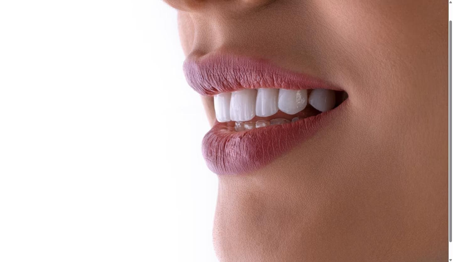Close-up of a smiling mouth showing straight white teeth, illustrating a cosmetic veneers result
