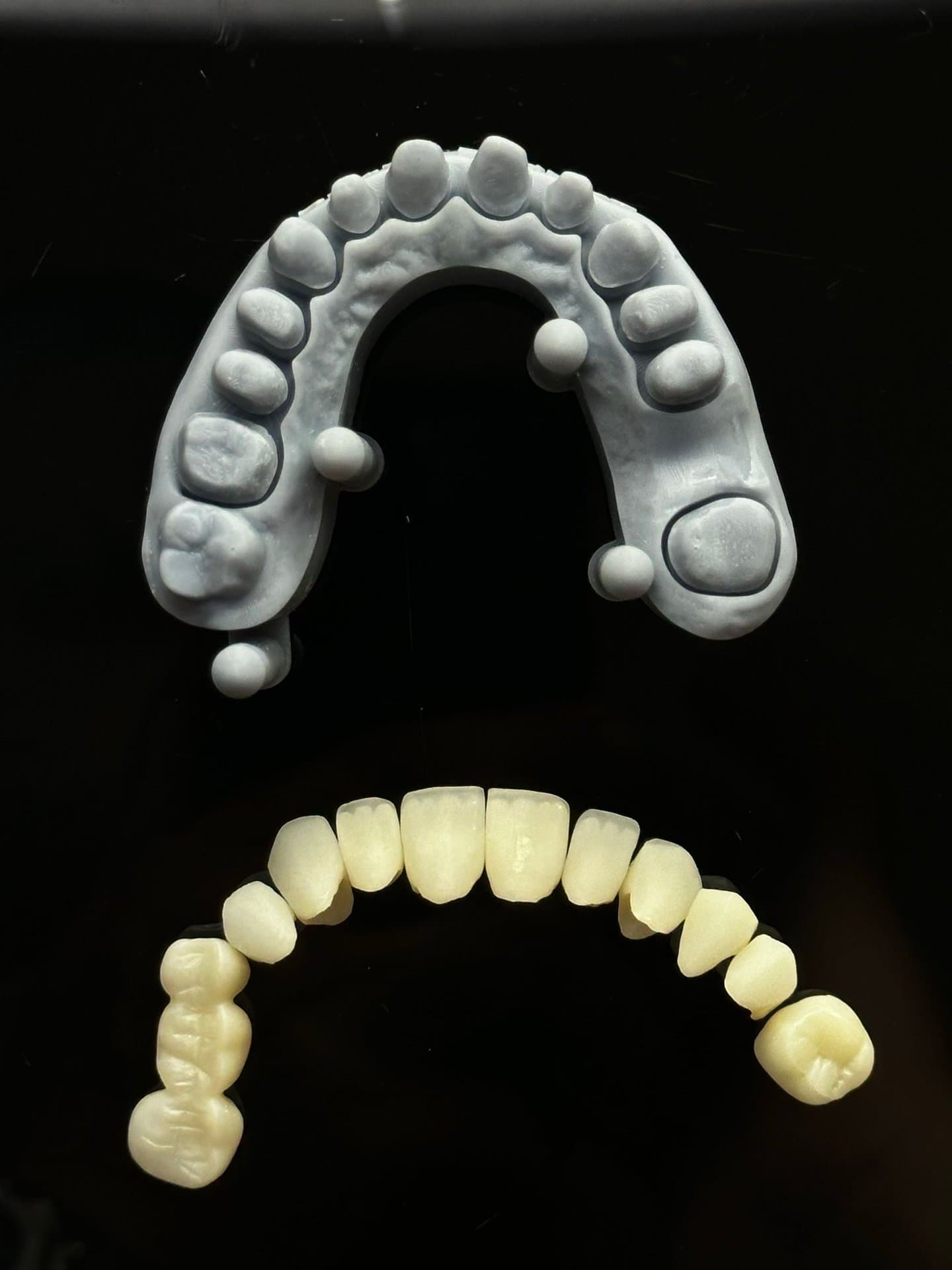 Close-up of a dental cast and prosthetic crown models on a dark background