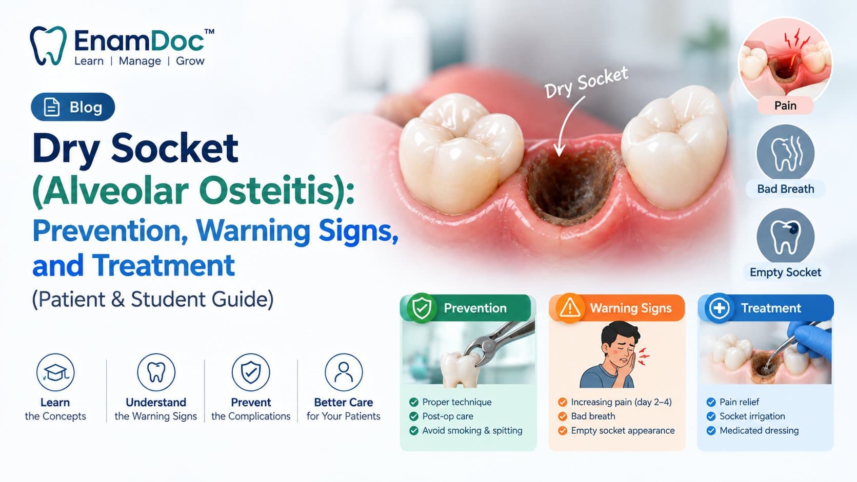EnamDoc blog cover explaining dry socket (alveolar osteitis), showing an extraction socket with pain and warning signs, along with prevention and treatment concepts for patients and dental students.