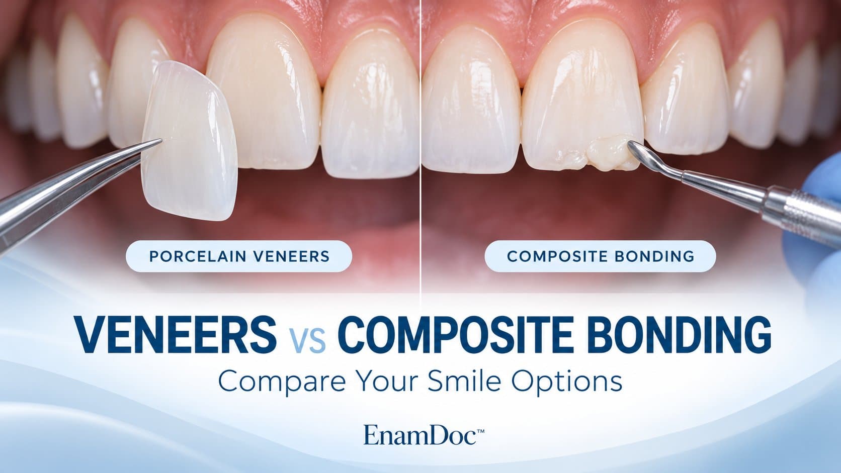 Side-by-side illustrations of a thin porcelain veneer and composite being applied to a chipped front tooth.