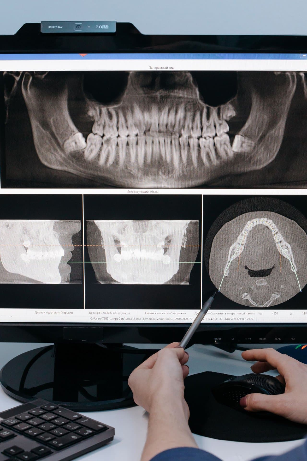 Dental panoramic X-ray images displayed on a monitor being reviewed by a clinician