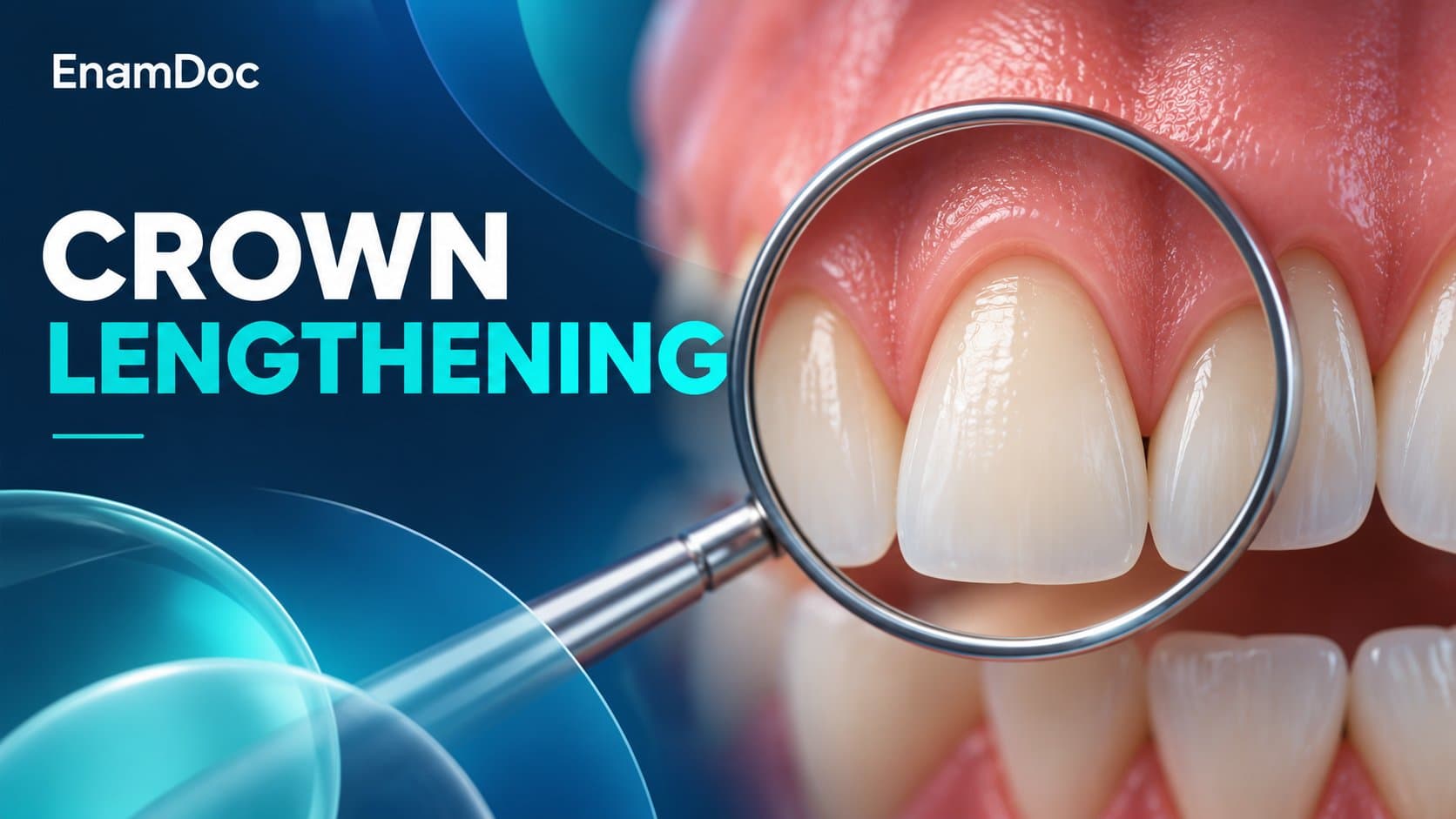 Illustration of a front tooth and gumline viewed through a dental mirror.