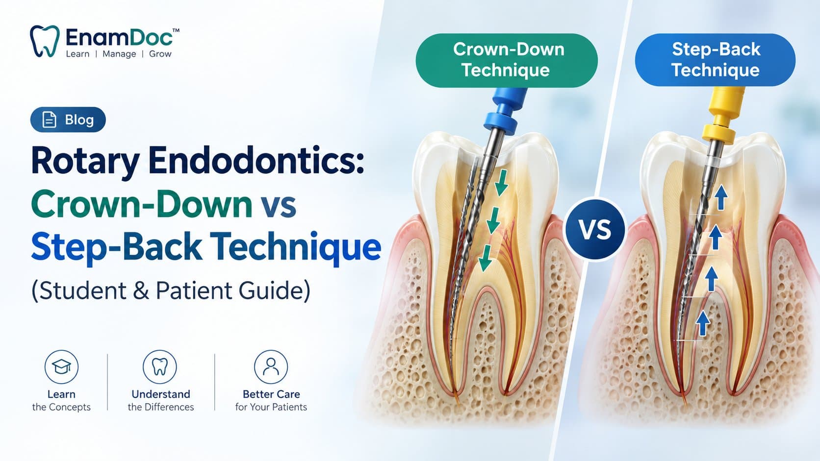 EnamDoc blog cover showing a visual comparison of Crown-Down and Step-Back techniques in rotary endodontics, with dental tooth cross-sections, endodontic files, directional arrows, and labels for students and patients.