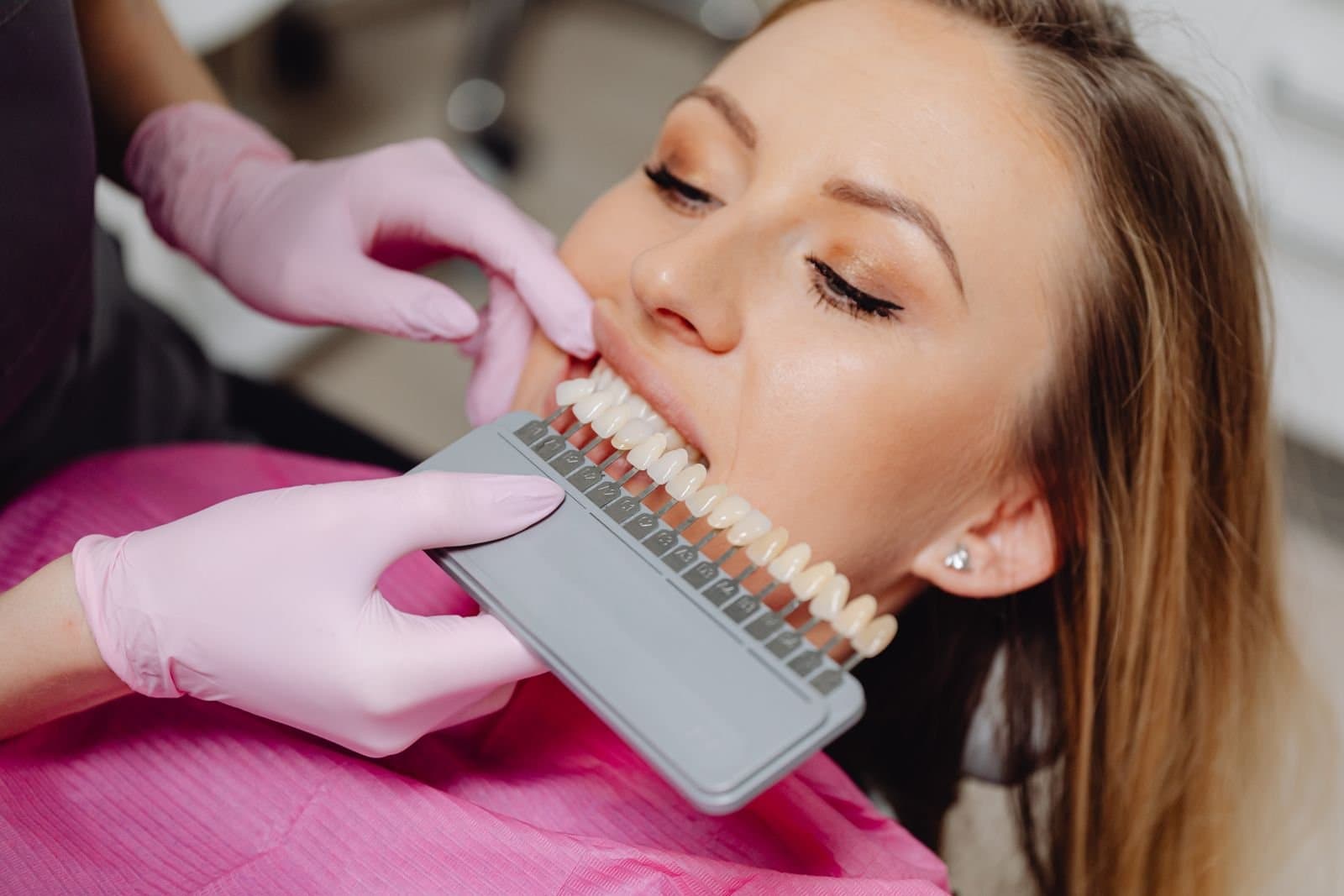 Dentist holding a tooth shade guide against a patient's teeth during a professional whitening consultation