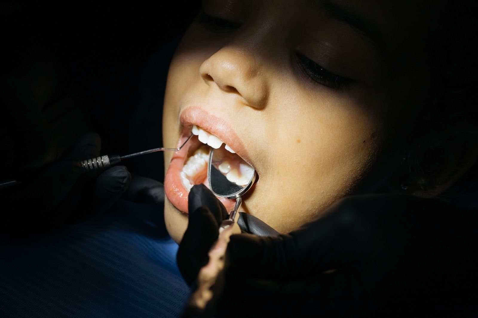 Close-up of a child during a dental checkup