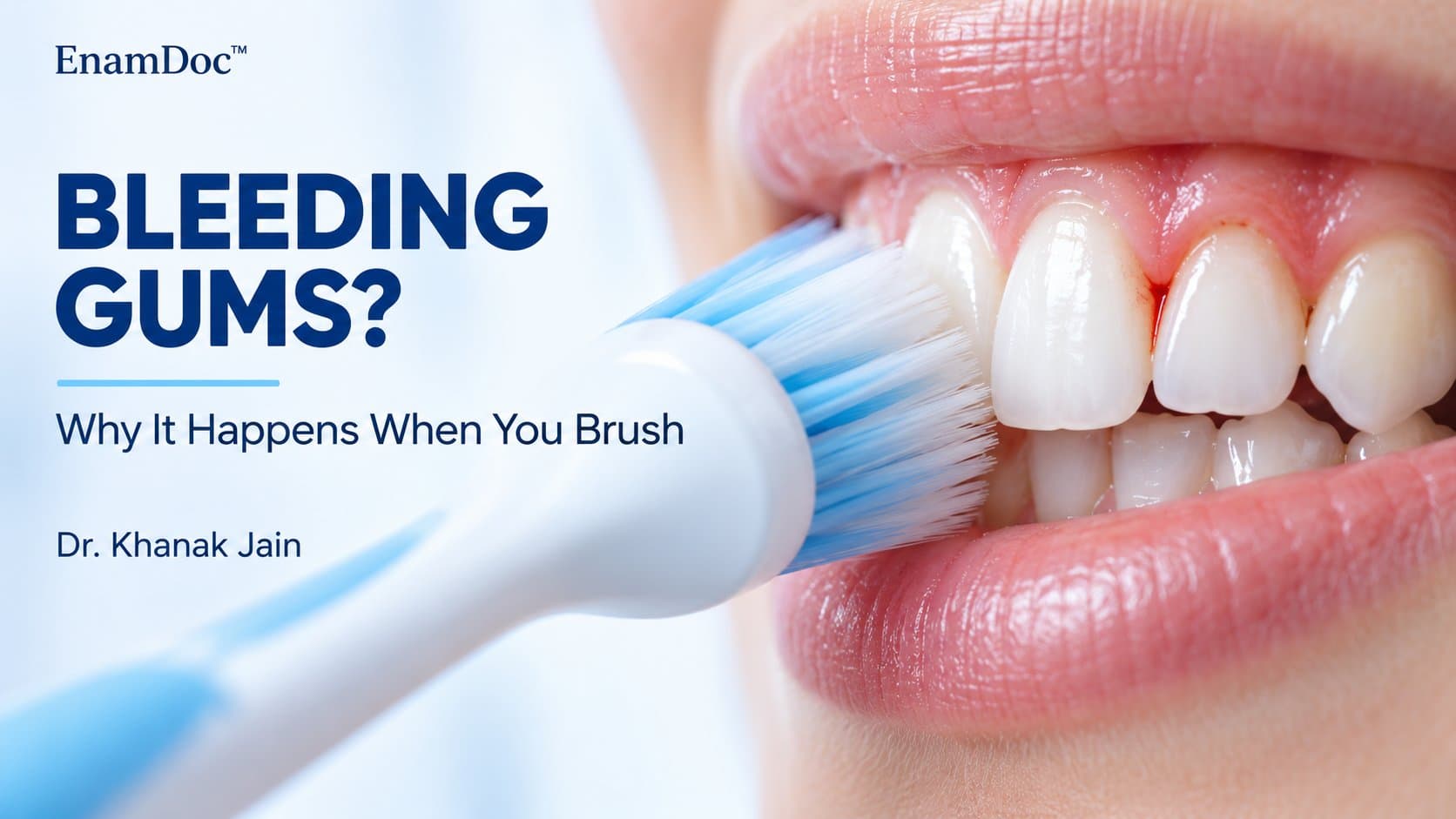 Close-up of a toothbrush at the gumline, showing inflamed gums and a small trace of bleeding between teeth.