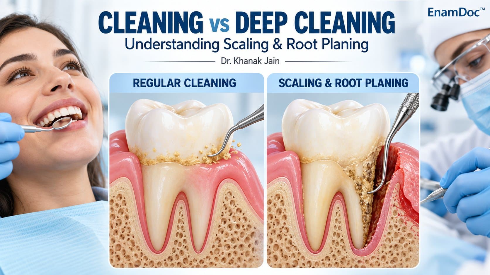 Dental cutaway illustrations comparing removal of surface deposits with cleaning along the root below the gumline.