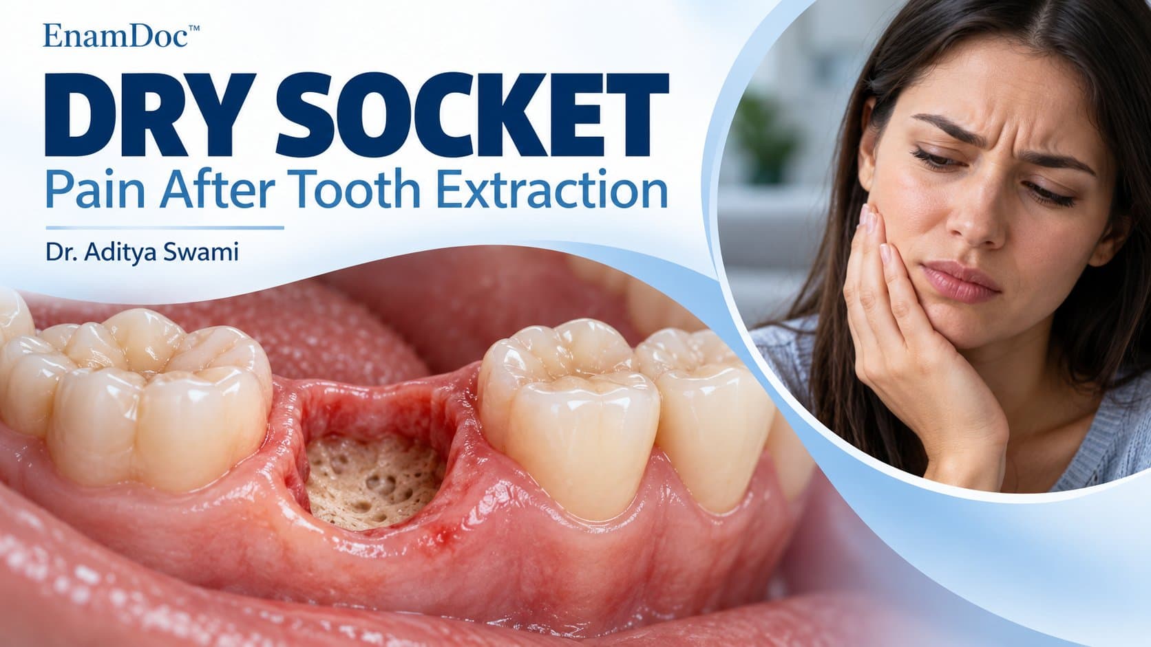 Close-up illustration of an empty extraction socket with exposed bone beside a woman holding her cheek.