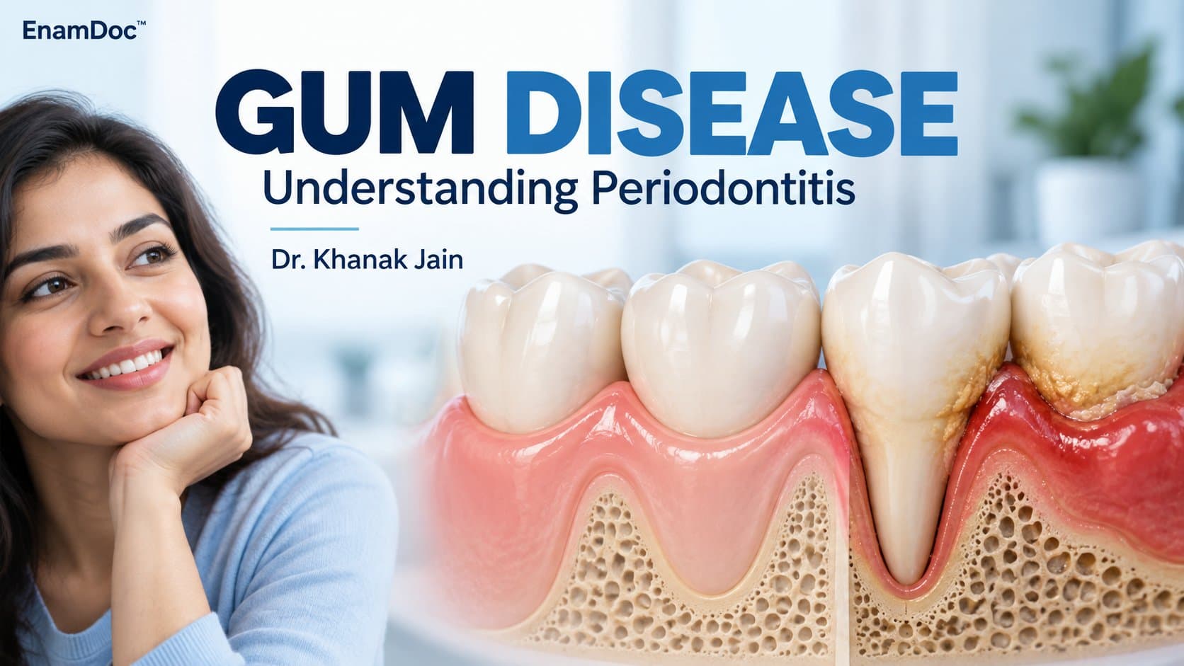 Dental illustration comparing healthy gums with inflamed gums, calculus deposits and reduced bone support.