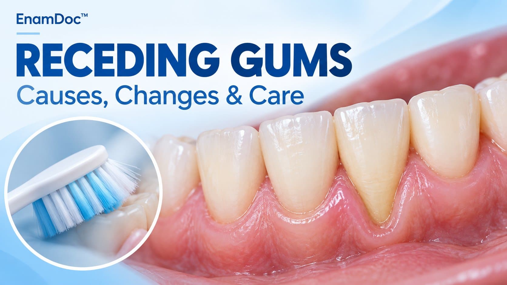 Close-up illustration of gum recession exposing a tooth root, with an inset showing gentle toothbrushing.