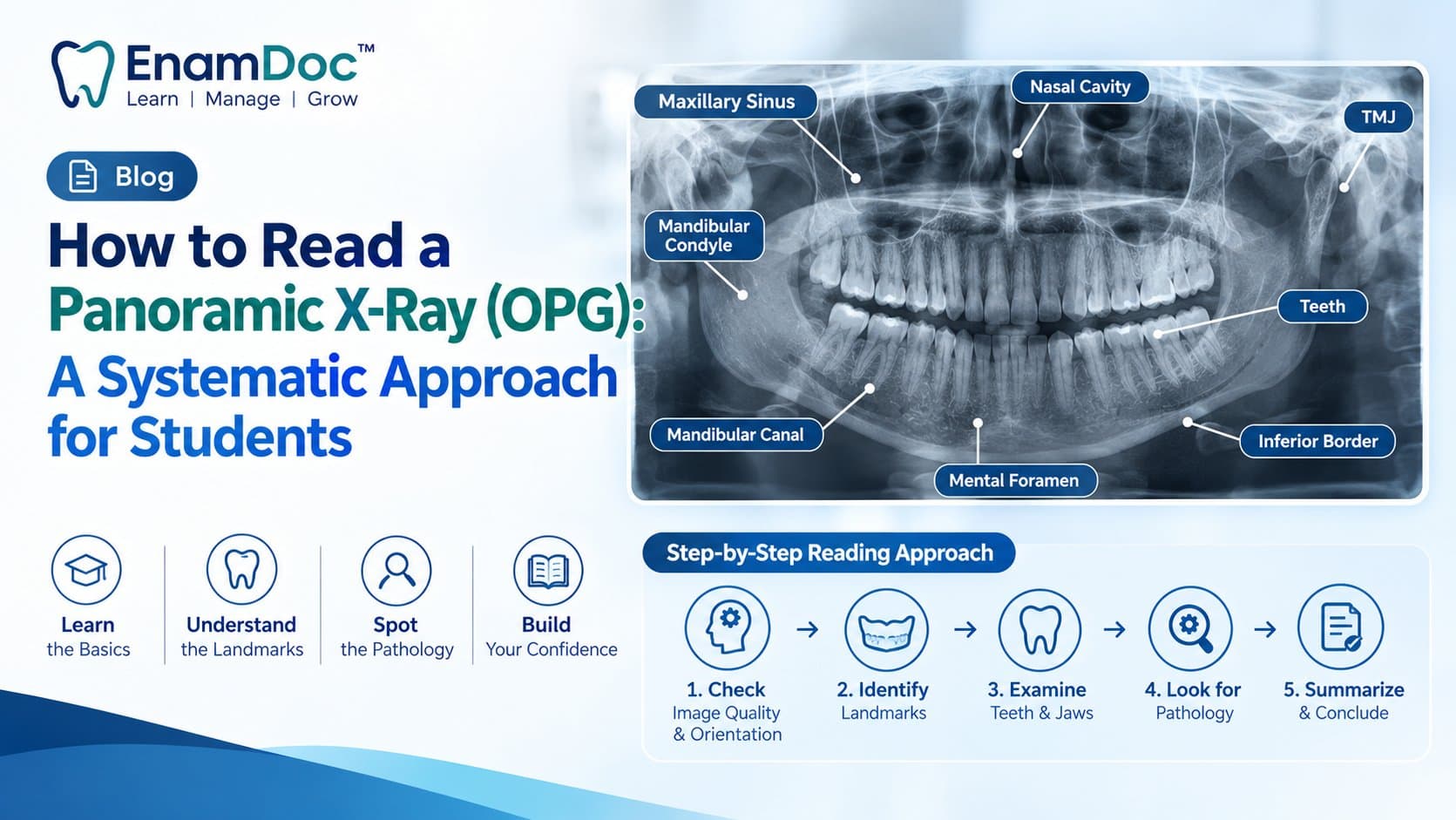EnamDoc blog cover showing a panoramic dental X-ray (OPG) with key anatomical landmarks labeled, including the maxillary sinus, nasal cavity, TMJ, mandibular canal, mental foramen, teeth, and inferior border, alongside a systematic step-by-step approach for dental students.