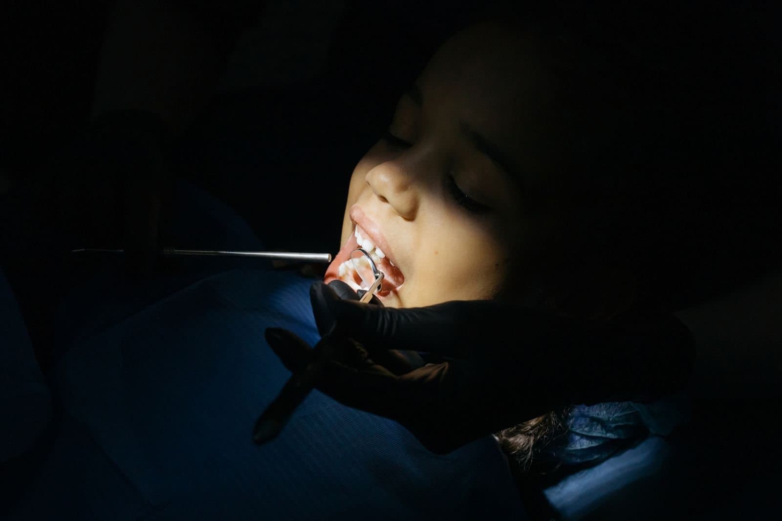 Close-up of a young patient's teeth during a dental checkup