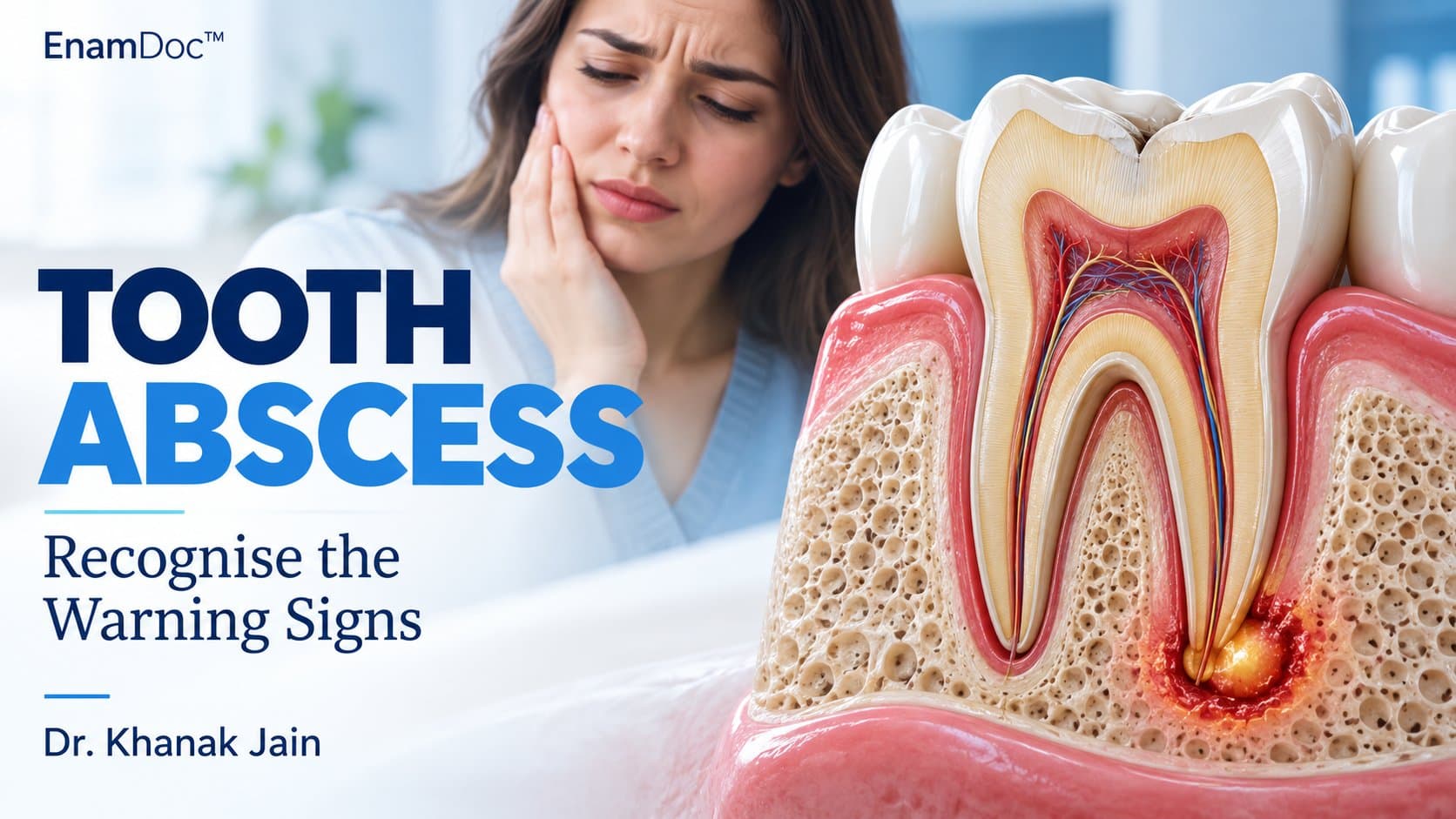 Cutaway illustration of a molar showing an abscess near the root tip, beside a woman holding her cheek.